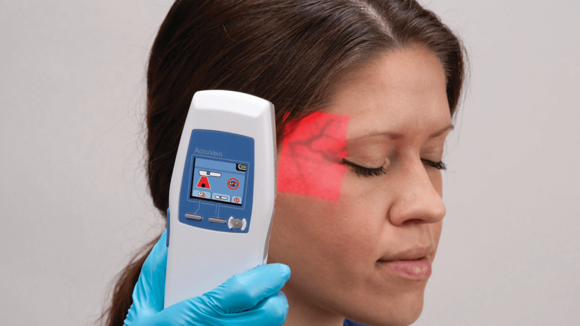 Leveraging AccuVein Technology to Further Reduce Bruising after Injecting